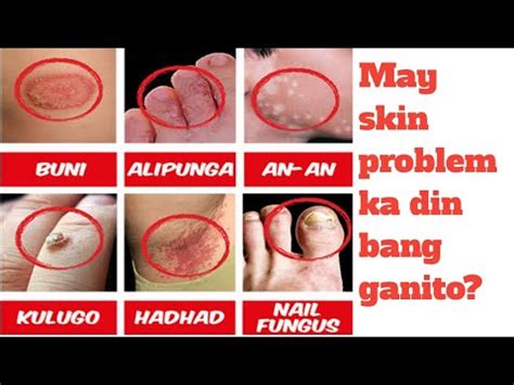 GAMOT SA BUNI,HAD-HAD, ALIPUNGA AT IBA PA - YouTube