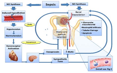 Sepsis is the Leading Cause of Death In Critical Care Patients - PLG Nursing Home Abuse ...