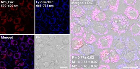 Subcellular distribution of LysoTracker Deep Red (blue color), and ...