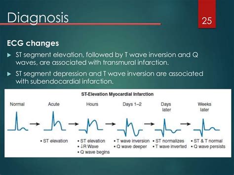 Acute Myocardial Infarction