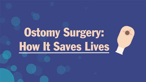 Ostomy Surgery: How It Saves Lives | MyOstomy.ca - Ostomy Product Store