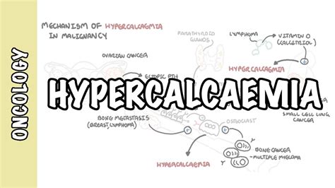 Hypercalcemia | hypercalcemia อาการ - Du lịch Hàng không Việt Nam AVITOUR