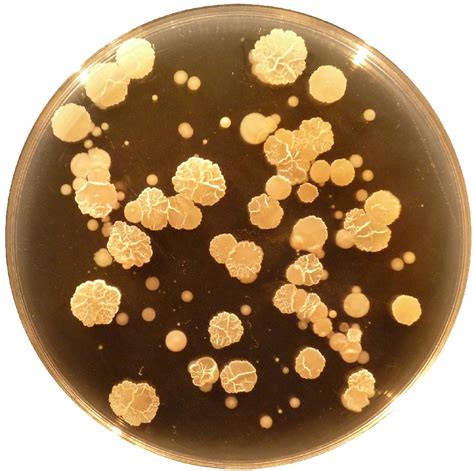 Gallery: Bacteria in Your Belly Button | Live Science