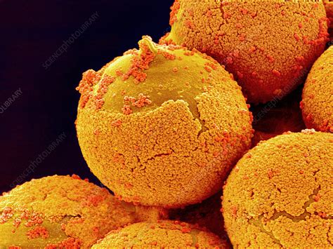 Cedar pollen, SEM - Stock Image - B786/0864 - Science Photo Library