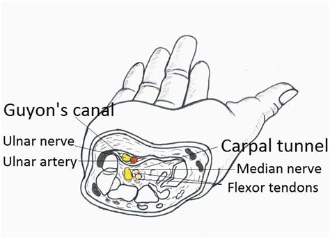 Guyon's canal and carpal tunnel image | Median nerve, Hand therapy, Carpal tunnel