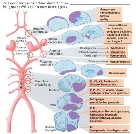 NEUROANATOMIA VASCULAR O que acontece em termos neurológicos quando há oclusão de cada segmento ...