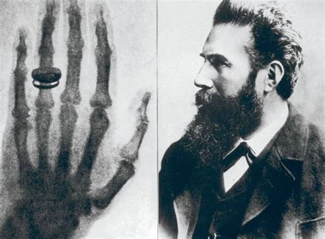 How Wilhelm Roentgen Discovered X-ray? – Different Truths | Wilhelm röntgen, Nobel prize in ...