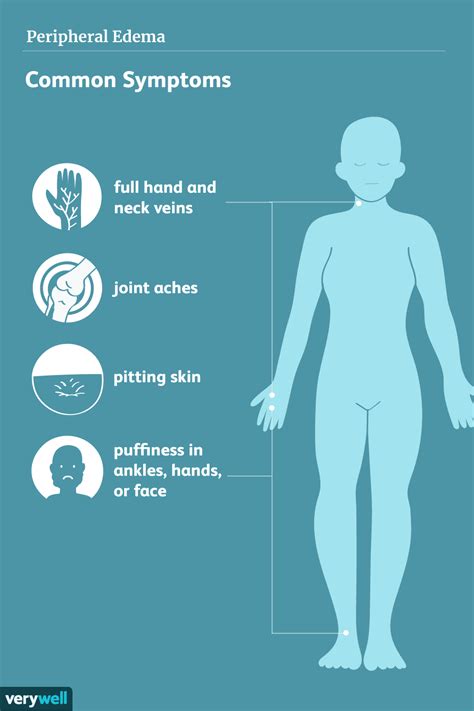 Causes and Types of Edema and How to Treat It