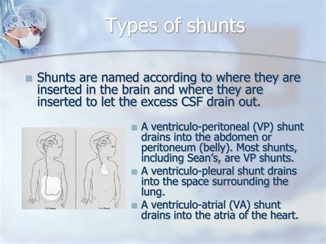 PPT - Hydrocephalus & Shunts PowerPoint Presentation - ID:431868