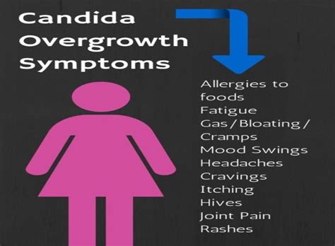 Candida Albicans - Symptoms and Treatment - Warm & Tote