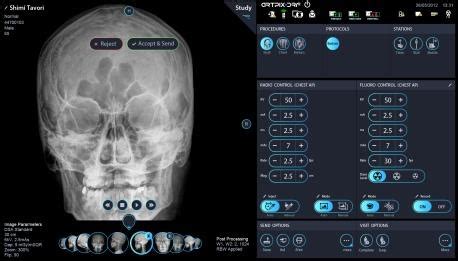 A unique imaging platform for dynamic X-ray applications • healthcare-in-europe.com