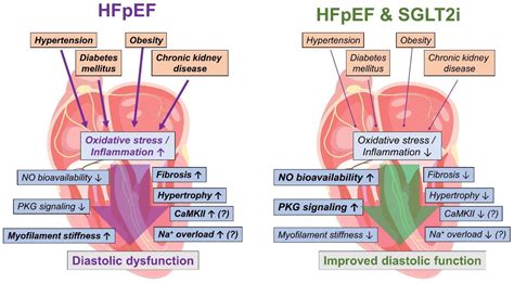 SGLT2 Inhibitors And Heart Failure