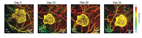 Photoacoustic Imaging | Centre for Advanced Biomedical Imaging - UCL ...