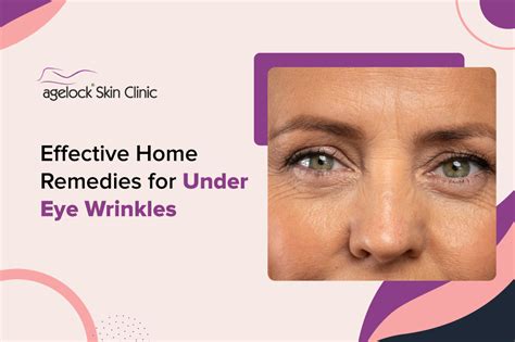 5 Effective Home Remedies for Under Eye Wrinkles - Agelock Skin Clinic