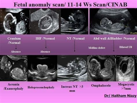 Pin on Fetal ultrasound | Ultrasound technician, Ultrasound sonography ...