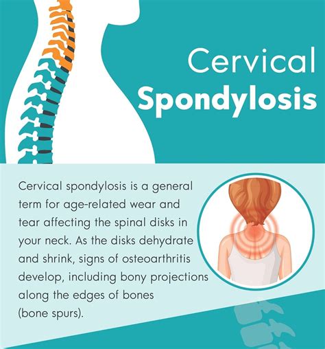 Cervical Spondylosis