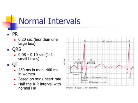 PPT - EKG Interpretation PowerPoint Presentation, free download - ID ...