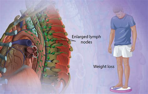 Health Condition : Symptoms, Causes, Treatment and More