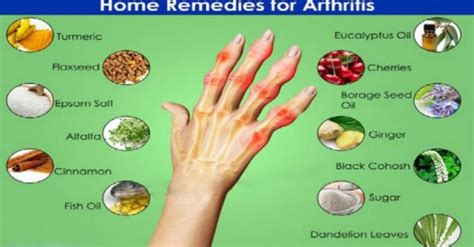 Best Natural Home Remedies for Osteoarthritis | Clamor World