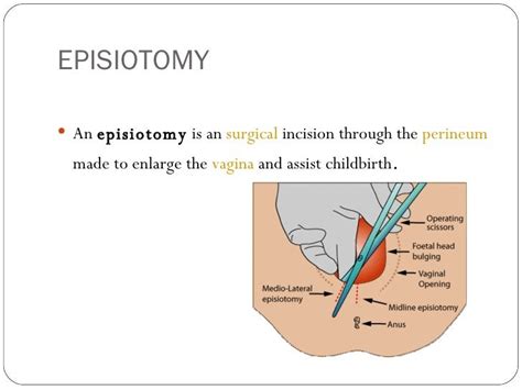 Module 2 Anatomy & Diseases