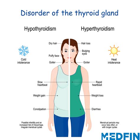 Thyroid Gland Disorders