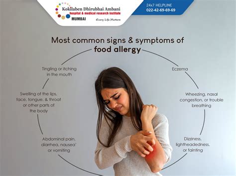 Most common signs of food allergy