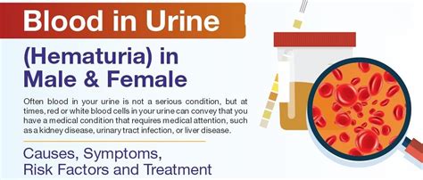 Causes, Symptoms, Prevention, Treatment Of Blood In Urine