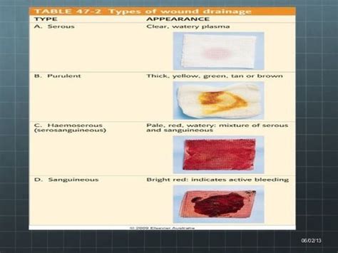 Inflamatory Exudates (6.4) Flashcards | Quizlet