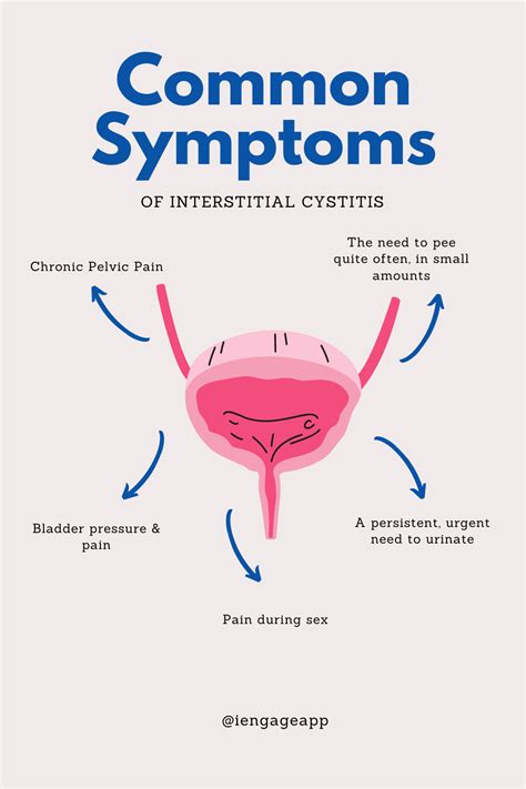 Interstitial cystitis symptoms and causes – Artofit