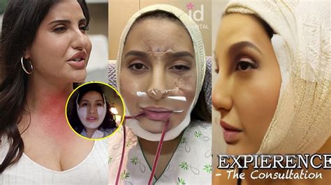 Nora Fatehi Looks Unrecognizable after Shocking Plastic Surgery, Chin Filler,Lip Fillers & Botox ...