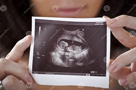 Ultrasound stock photo. Image of baby, concept, belly - 19503756