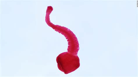 Tapeworms and four other disgusting parasites - CNN.com