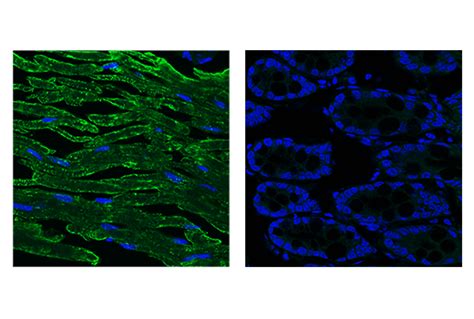 Myelin Protein Zero Antibody | Cell Signaling Technology