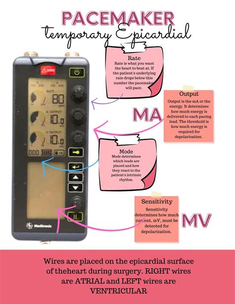 Nursing Notes, Temporary Pacemaker Cheat Sheet, Epicardial Pacemakers, ICU Cheat Sheets, Notes ...