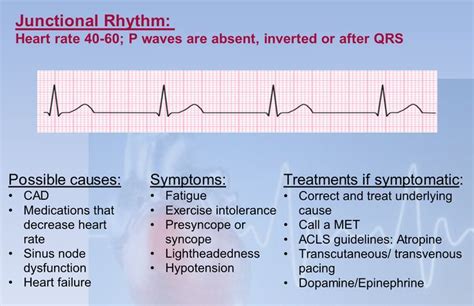 Junctional Rhythm | P wave, Sinusitis, Acls