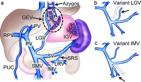 Anatomical schematics of the portal venous circulation. (a) illustrates... | Download Scientific ...