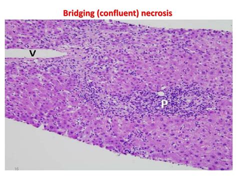 PPT - Hepatic Failure-1,2 PowerPoint Presentation, free download - ID:3635560