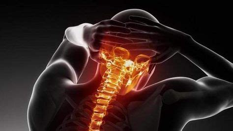 Arthritis in Neck | Arthritis treatment, Arthritis, Rheumatoid arthritis treatment