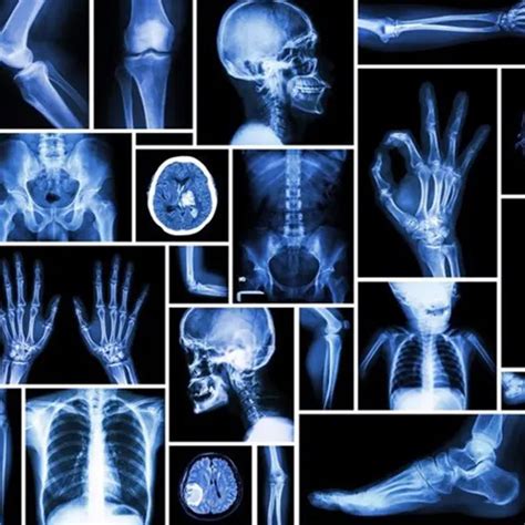 What Are Different Types Of X-Rays | Ganesh Diagnostic