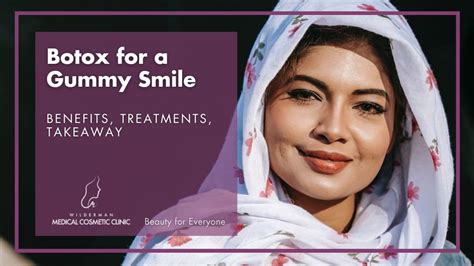 Botox for a Gummy Smile | Wilderman Cosmetic Clinic | Thornhill