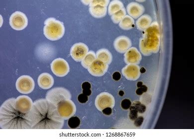 Backgrounds Characteristics Different Shaped Colony Bacteria Stock Photo 1268867659 | Shutterstock