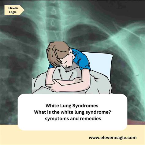 White Lung Syndromes: What Is The White Lung Syndrome? Symptoms And ...