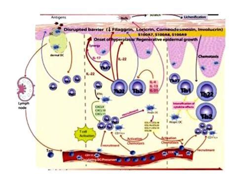 Breaking Down the Mechanism of Dupixent for Eczema Treatment