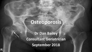 Osteoporosis 2018 | PPT