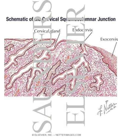 Schematic of the Cervical Squamocolumnar Junction