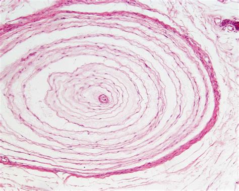 File:Pacinian corpuscle histology 03.jpg - Embryology