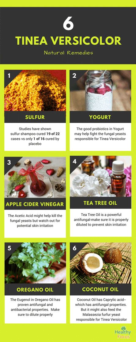 10 Amazing Home Remedies for Tinea Versicolor - Healthy Focus