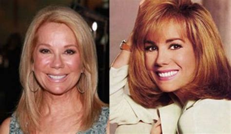 Kathie Lee Gifford before and after plastic surgery 07 – Celebrity plastic surgery online