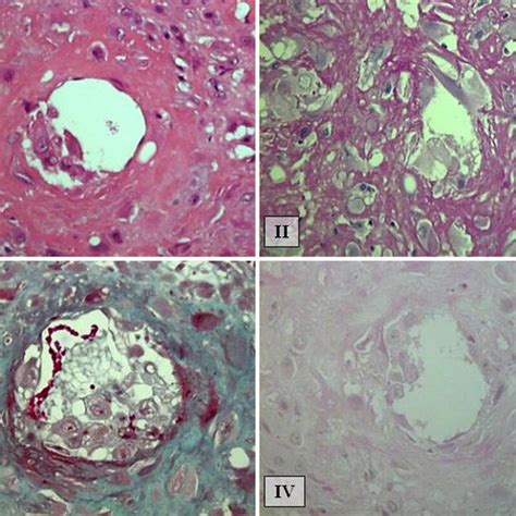 Extravillous trophoblast (EVT) cell populations: cells islands covering... | Download Scientific ...