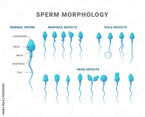 Sperm morphology count type educational medical scheme vector flat ...